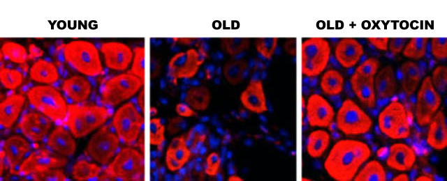 muscle tissues